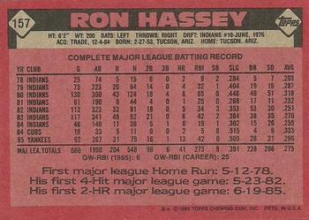 1986 Topps #157 Ron Hassey Back