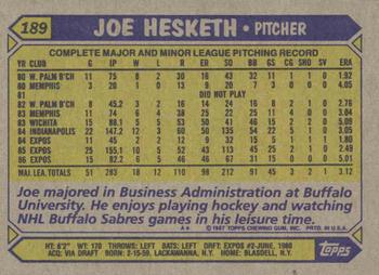 1987 Topps #189 Joe Hesketh Back