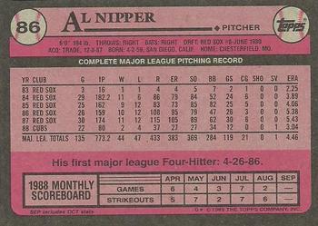 1989 Topps #86 Al Nipper Back