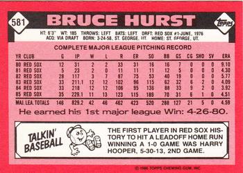 1986 Topps - Collector's Edition (Tiffany) #581 Bruce Hurst Back
