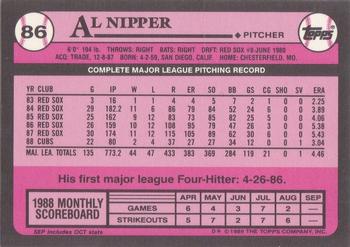 1989 Topps - Collector's Edition (Tiffany) #86 Al Nipper Back