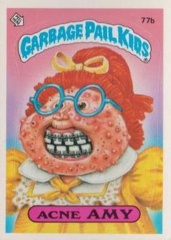 1985 Topps Garbage Pail Kids Series 2 #77b Acne Amy Front