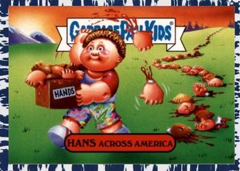 2018 Topps Garbage Pail Kids We Hate the '80s - Bruised #6a Hans Across America Front