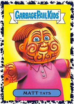 2019 Topps Garbage Pail Kids We Hate the '90s - Bruised #9b Matt Tats Front