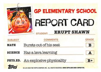 2020 Topps Garbage Pail Kids: Late to School - Bruised Black #85a Erupt Shawn Back