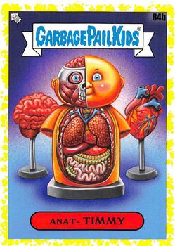 2020 Topps Garbage Pail Kids: Late to School - Phlegm Yellow #84b Anat-Timmy Front
