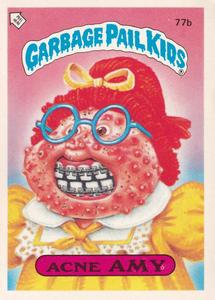 1985 Topps Garbage Pail Kids Series 2 (UK) #77b Acne Amy Front