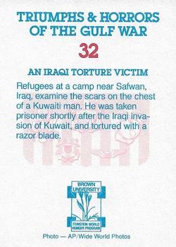 1991 Triumphs & Horrors of the Gulf War - Gold Foil Edition #32 An Iraqi Torture Victim Back