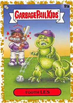 2020 Topps Garbage Pail Kids 35th Anniversary - Fools Gold 35th #91a Tooth Les Front