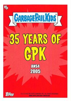2020 Topps Garbage Pail Kids 35th Anniversary - Phlegm Yellow #74b Swinging Stuart Back