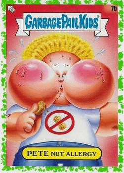 2021 Topps Garbage Pail Kids: Food Fight! - Booger Green #7b Pete Nut Allergy Front