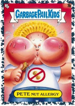 2021 Topps Garbage Pail Kids: Food Fight! - Pepper Black #7b Pete Nut Allergy Front