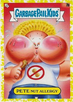 2021 Topps Garbage Pail Kids: Food Fight! - Mustard Yellow #7b Pete Nut Allergy Front