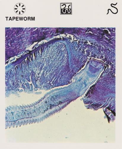 1975-80 Leisure Books Wildlife Treasury #6132-13 Tapeworm Front
