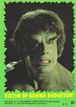 1979 Topps The Incredible Hulk #87 Victim of Gamma Radiation! Front